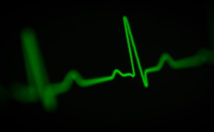 Tachycardie : comprendre les causes possibles