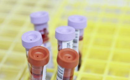 Tubes de sang pour analyse de la protéine C réactive